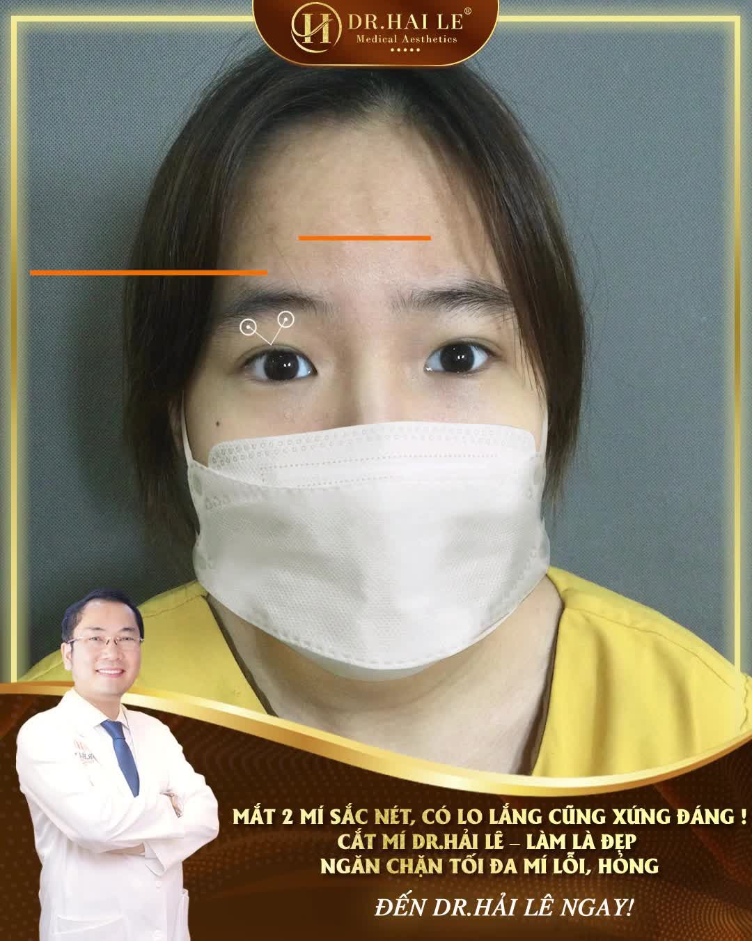"Cảm thấy mắt sắc nét, có hồn hơn!"