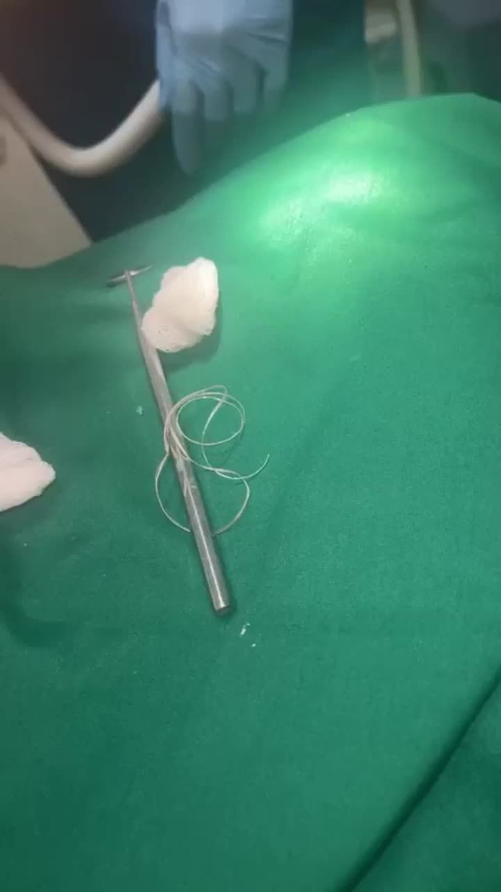 Dán sứ Veneer - Phương pháp thẩm mỹ răng sứ không cần mài răng