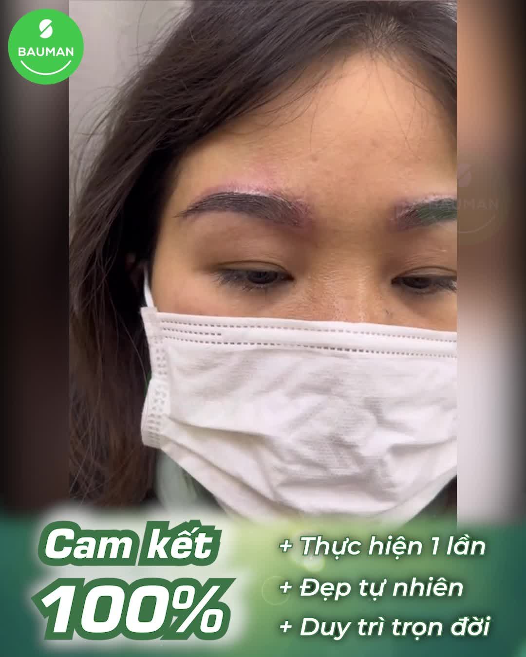 Cấy lông mày nữ khắc phục lỗi phun xăm