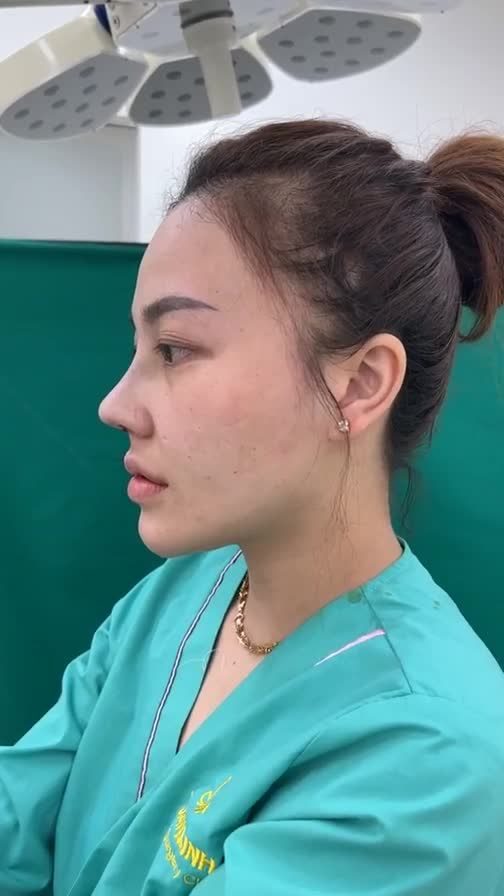 Ca mũi cấu trúc vừa hoàn thành !!