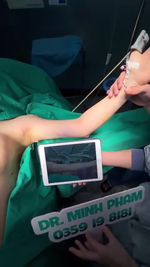 Ca hút mỡ cánh tay vừa được thực hiện xong bởi ekip Dr.Minh Phạm