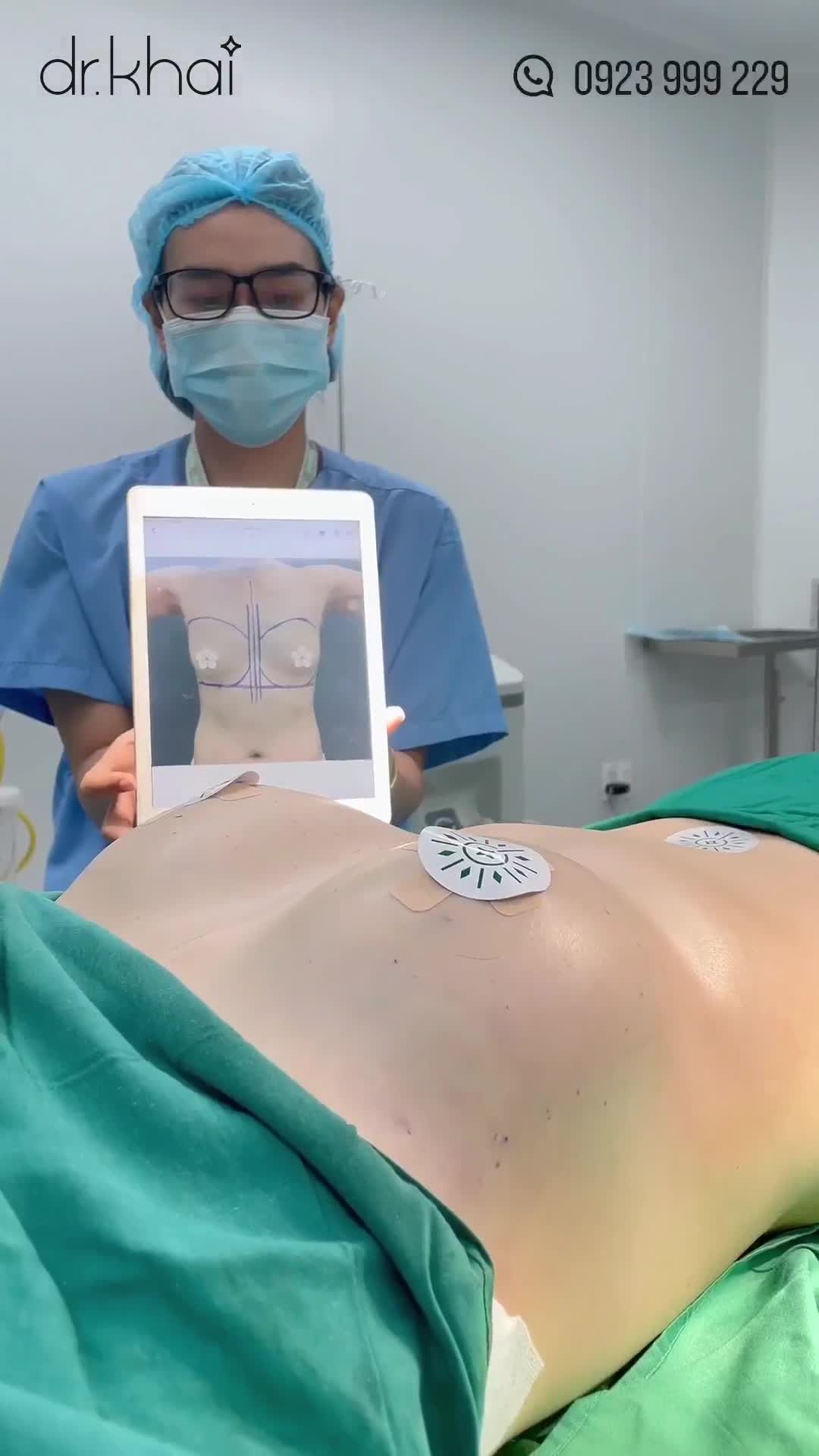 CẢI THIỆN VÒNG 1 CÓ MÔ TUYẾN BỊ TEO LÉP