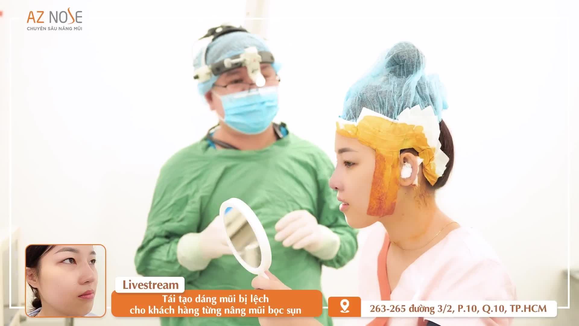 Dáng mũi Sline cao vừa mềm mại sau khi tái tạo mũi h.ỏng