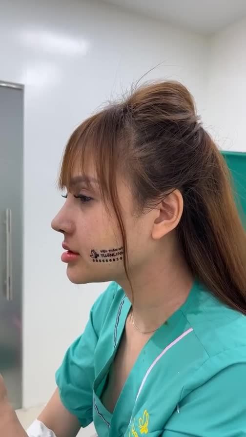 Case mũi cấu tr￼úc vừa hoàn thành