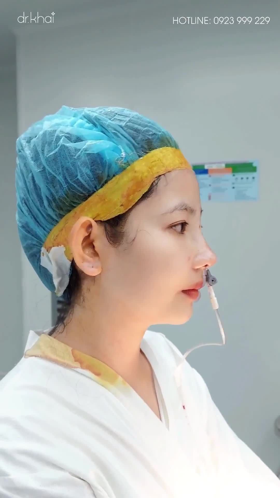 KHÁCH NÂNG MŨI CẤU TRÚC PHONG THỦY ĐẸP NGẤT NGÂY