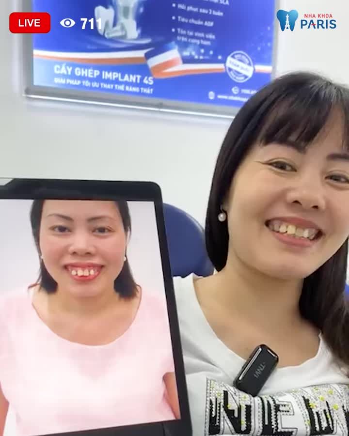 3 năm kiên trì với Niềng Răng tại nha khoa Paris sau khi tham khảo nhiều nha khoa