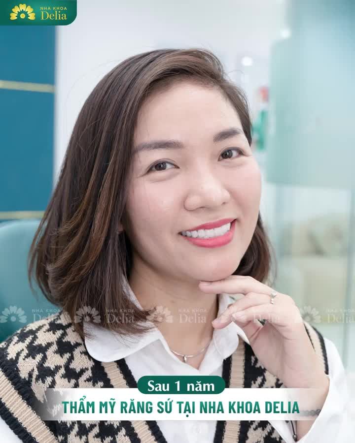 Chồng chị lúc đầu không ủng hộ chị đi làm răng đâu, tại anh sợ đẹp trước mắt hại về sau này.