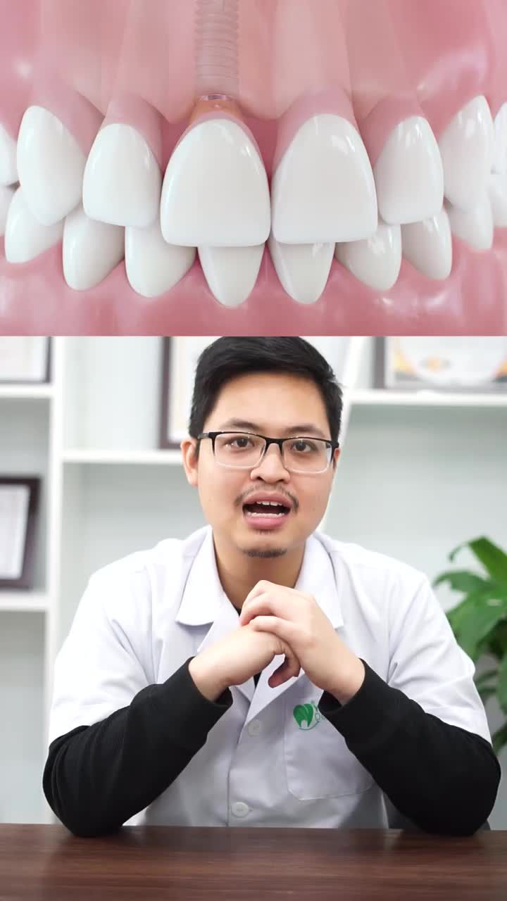 Trồng implant có đau không? Tất Tần Tật về Implant P1