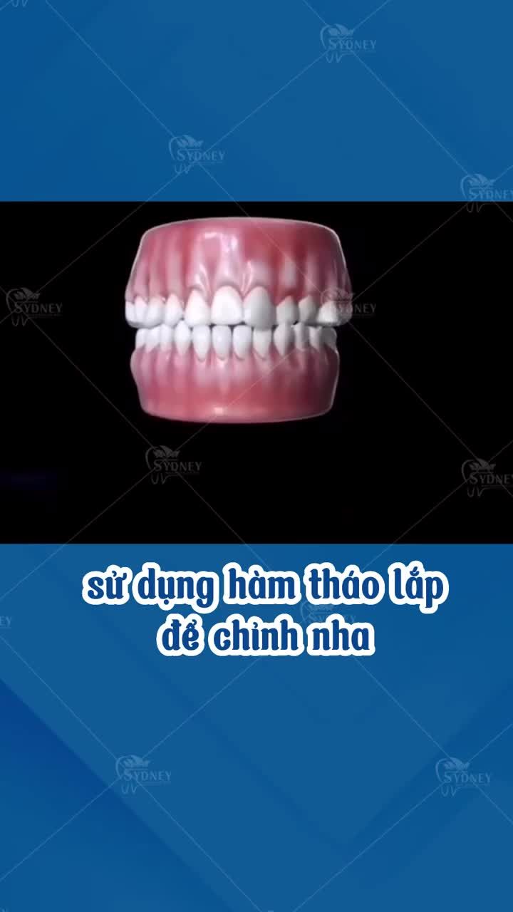 Bạn chọn gì cho hành trình niềng răng của mình?