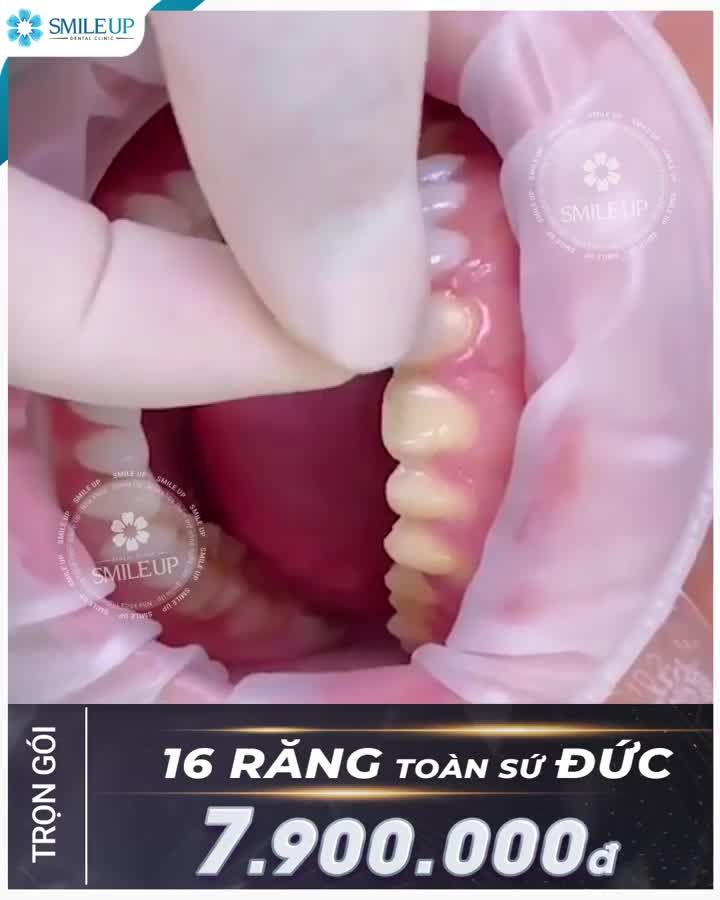 CHỈ CÒN 20 SUẤT ƯU ĐÃI CỰC KHỦNG CHO NGÀY 8-3