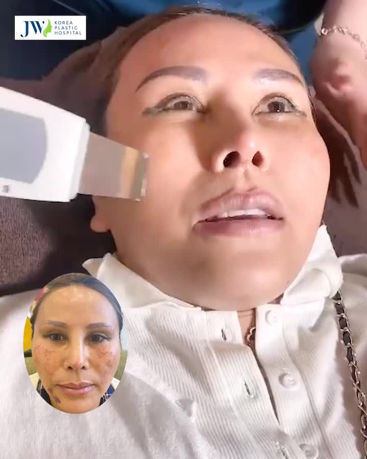 BÍ QUYẾT SỞ HỮU LÀN DA TRẮNG SÁNG KHÔNG TÌ VẾT CHỈ SAU 6 NGÀY.