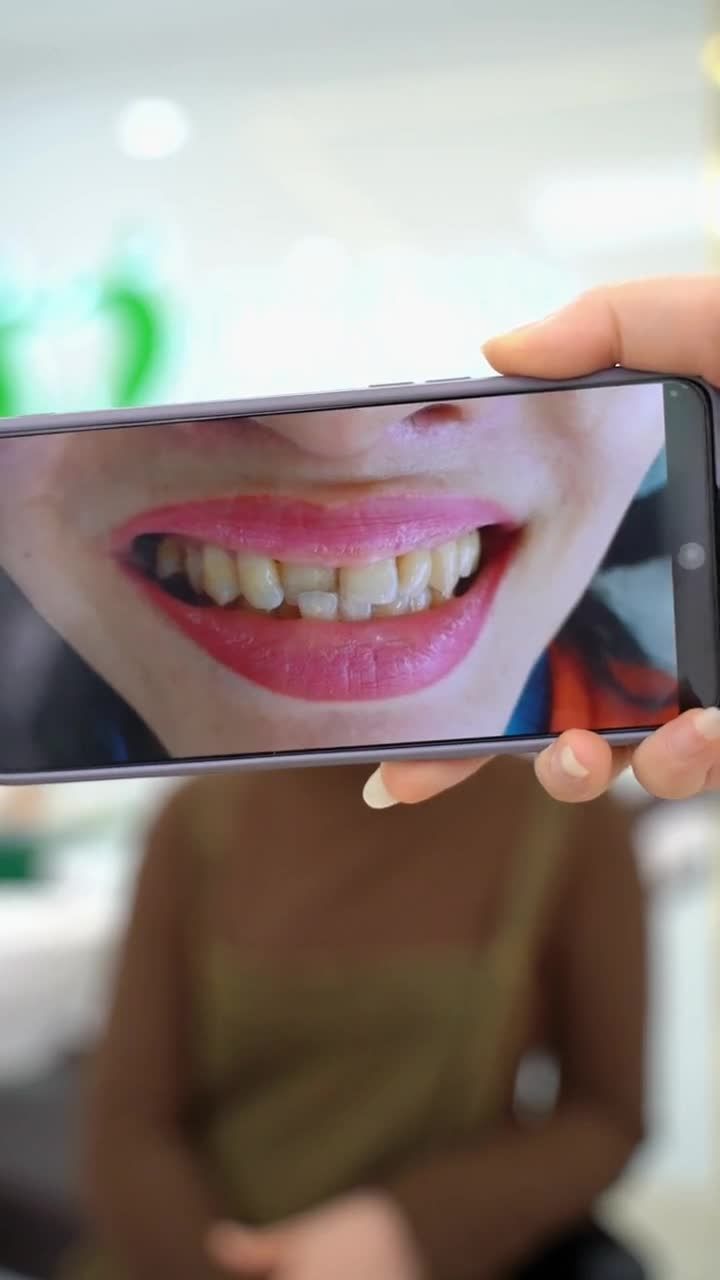 NỮ KHÁCH HÀNG THẨM MỸ 22 RĂNG SỨ CAO CẤP