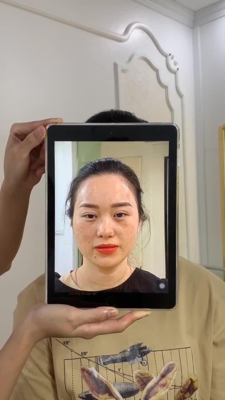 BẤT NGỜ VỚI KẾT QUẢ DA CĂNG BÓNG, MƯỚT MỊN TỰ NHIÊN SAU 5 BUỔI LÀM ĐẸP TẠI XUÂN HƯƠNG