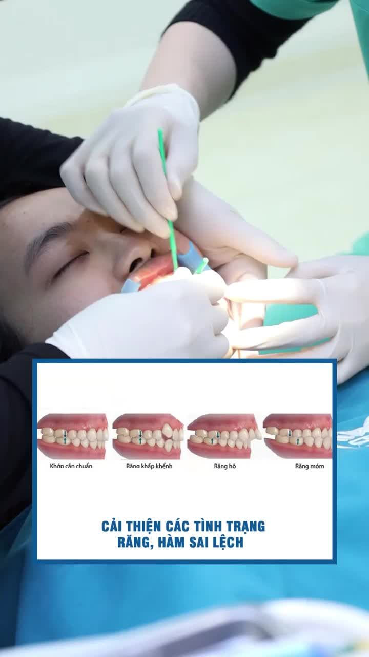 Biến chứng nguy hiểm khi niềng răng sai cách
