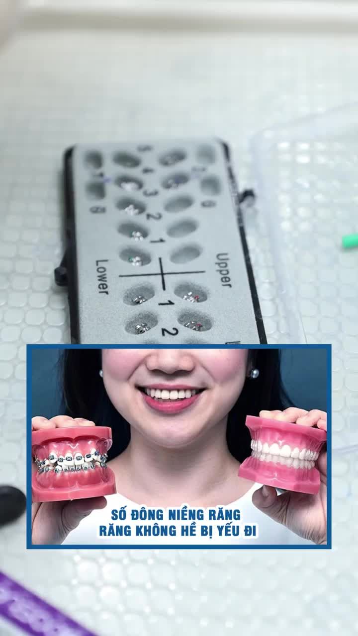 Răng có thể bị yếu đi do niềng hay không?