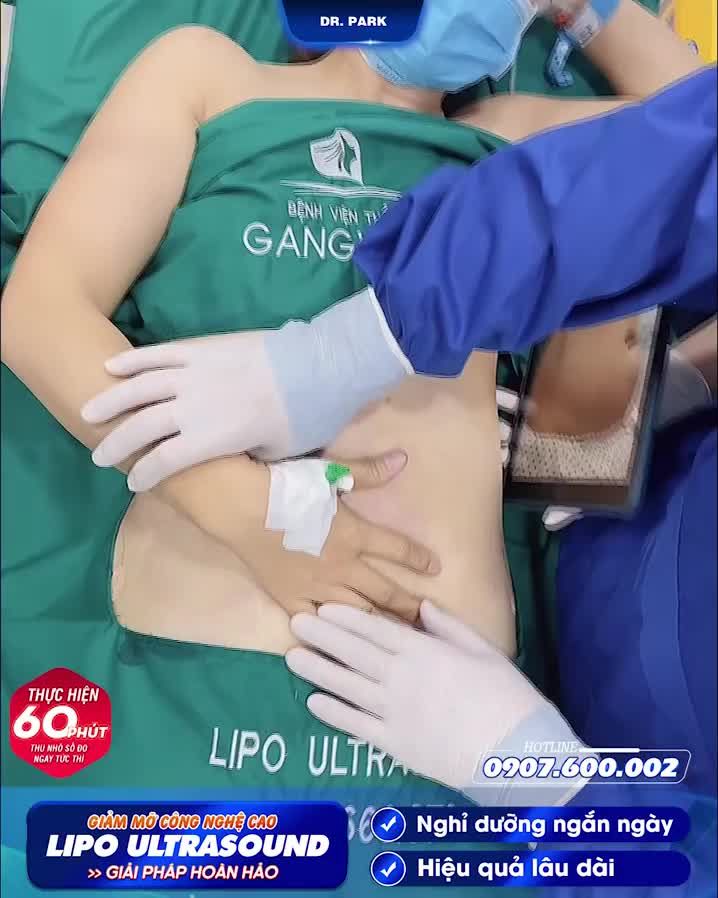 LIPO ULTRASOUND – PHƯƠNG PHÁP HÚT MỠ HIỆN ĐẠI HÀNG ĐẦU BẠN NÊN BIẾT