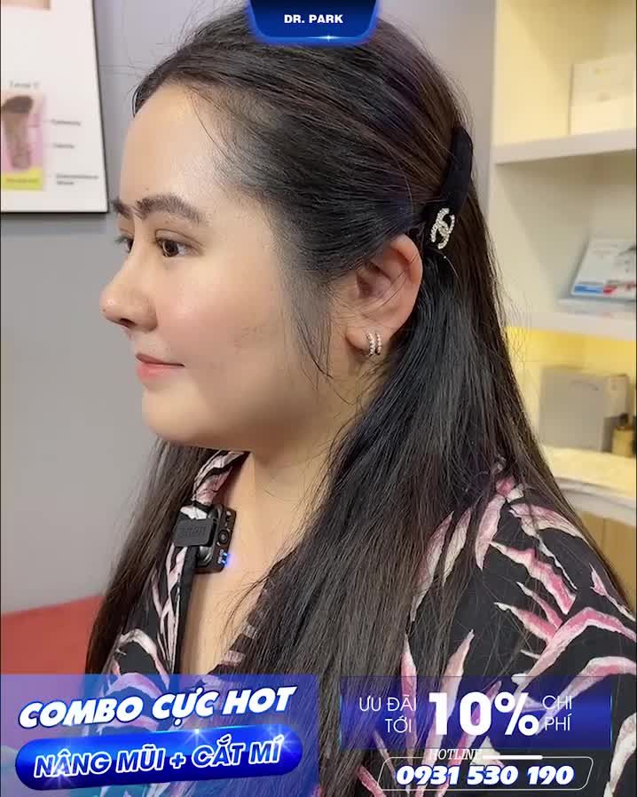 CHĂM SÓC VẾT MỔ KHÔNG ĐỂ LẠI SẸO SAU NÂNG MŨI, CẮT MÍ