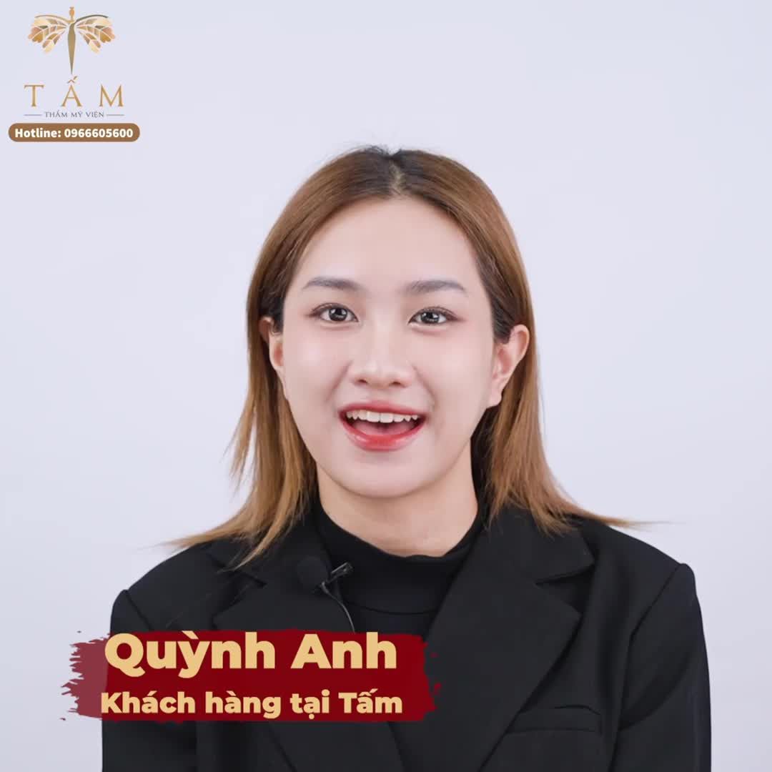 Tự tin khoe sắc sau 20 phút làm Filler đầy má tại Tấm.