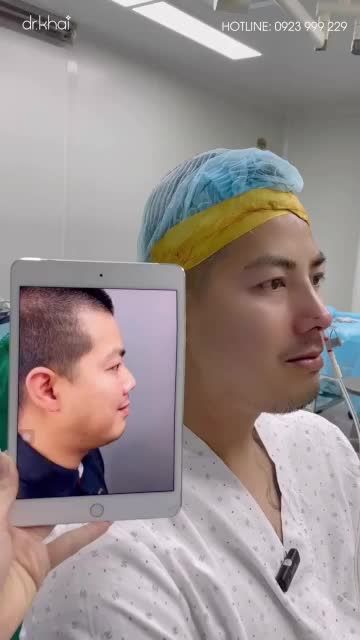 KHÁCH NAM TỪ SYDNEY-ÚC VỀ VIỆT NAM CHỌN NÂNG MŨI CẤU TRÚC TẠI BÁC SĨ KHẢI