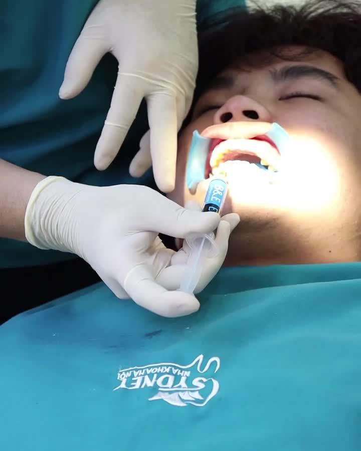 Niềng răng có hại không?
