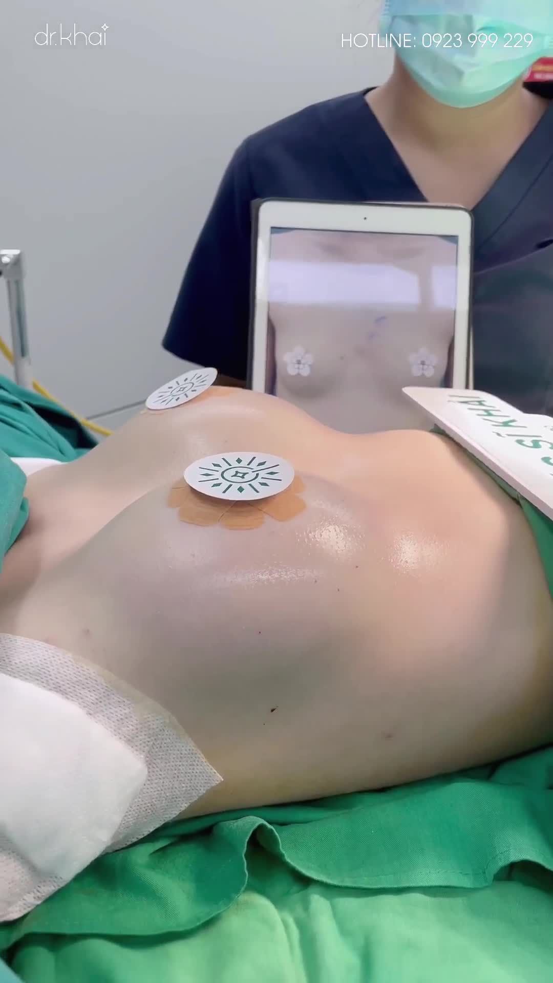 DA NGỰC MỎNG CÓ THỂ ĐẶT TÚI NGỰC ĐƯỢC KHÔNG?