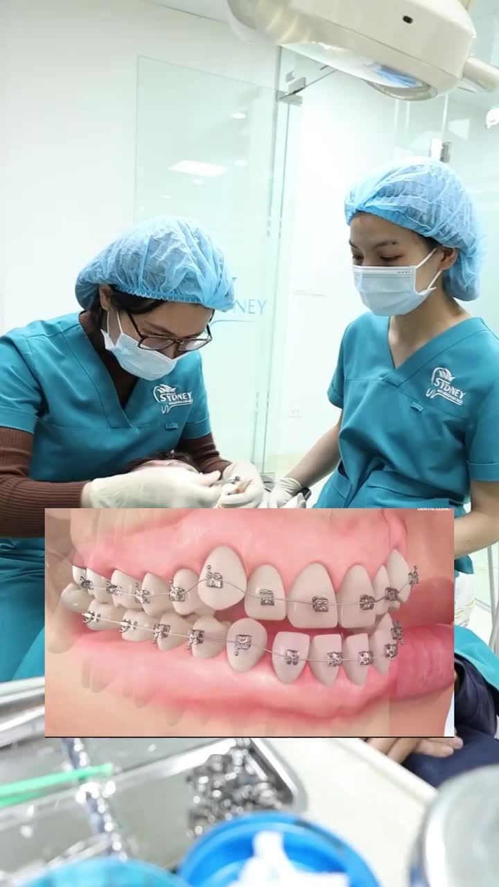 Sưng viêm nướu lợi khi niềng răng có nguy hiểm không?
