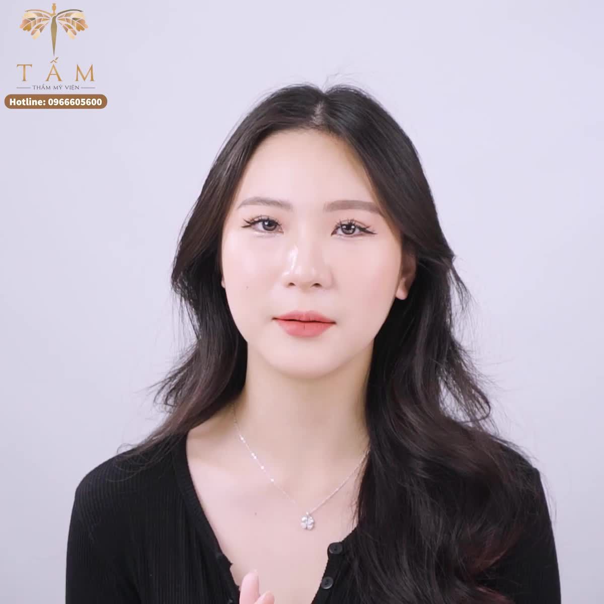 Bật mí lí do lựa chọn Filler tại Tấm của bạn khách hàng Hạnh Nguyên.