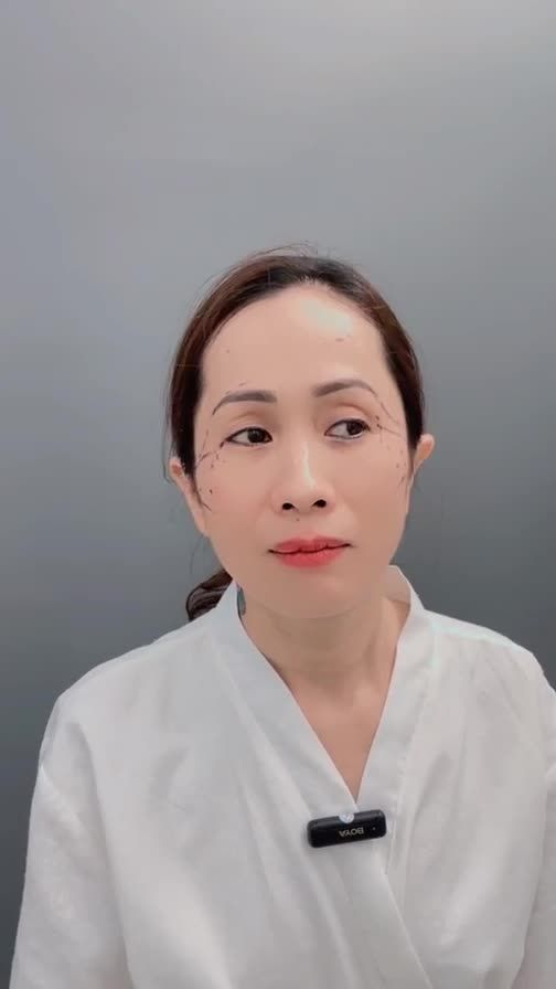 2 chị bạn đến từ Đài Loan trước khi làm phẫu thuật combo lớn