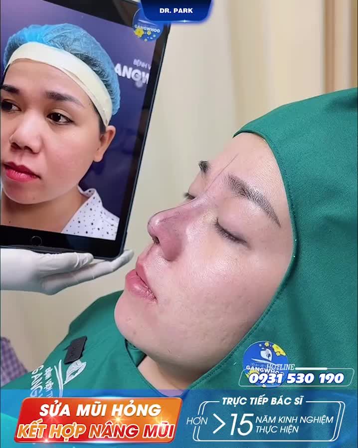 VÌ SAO NÊN SỬA MŨI HỎNG CÀNG SỚM CÀNG TỐT?