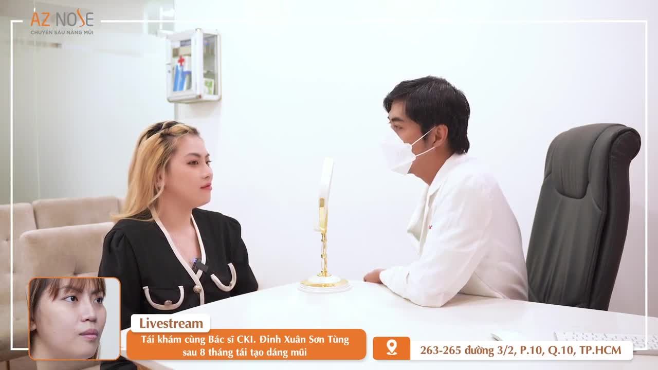 Đầu mũi c.ụp thay đổi thế nào sau 8 tháng tái tạo dáng mũi?