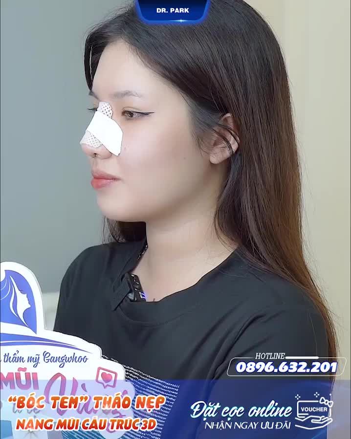 KHOE KHÁCH HÀNG NÂNG MŨI CẤU TRÚC NHÀ BÁC SĨ PARK