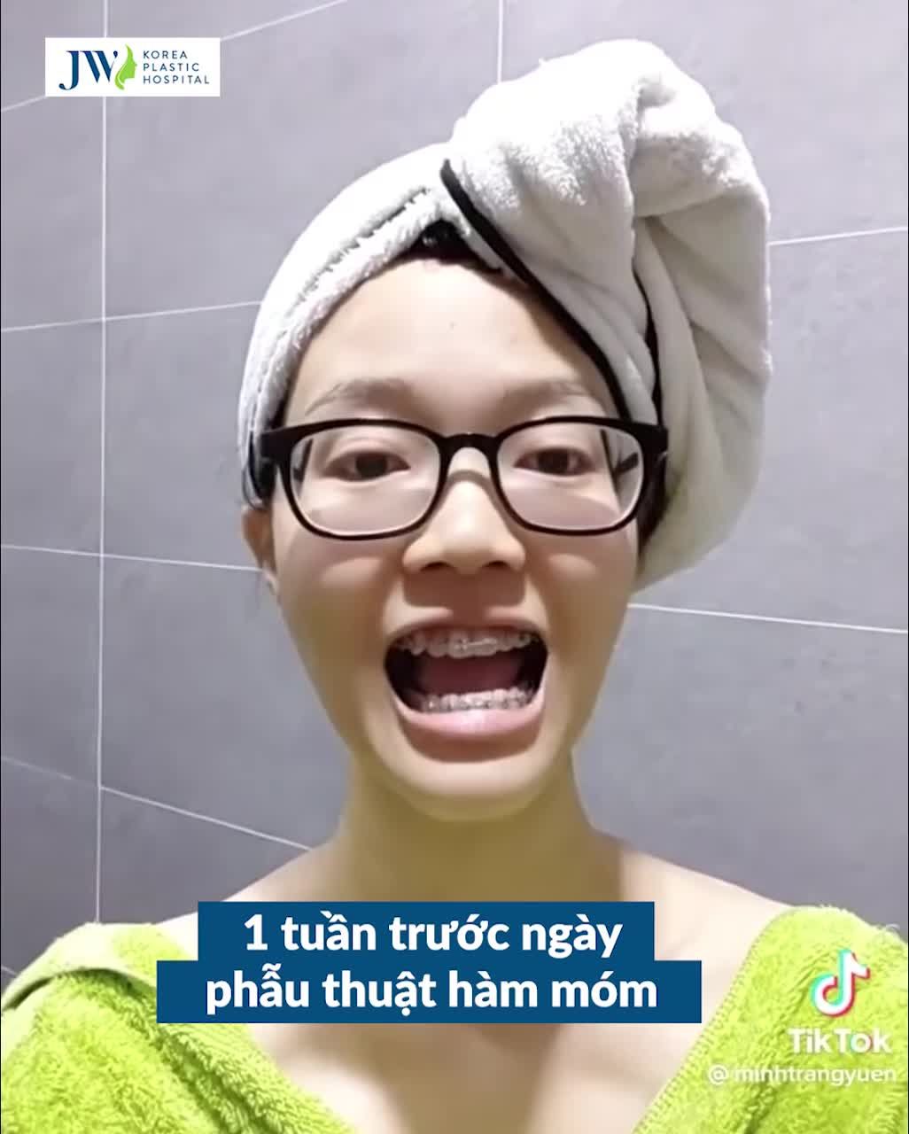 HÀNH TRÌNH PHẪU THUẬT HÀM MÓM – NỮ SINH GEN Z LỘT XÁC, TẠM BIỆT GƯƠNG MẶT CÁ MÓM