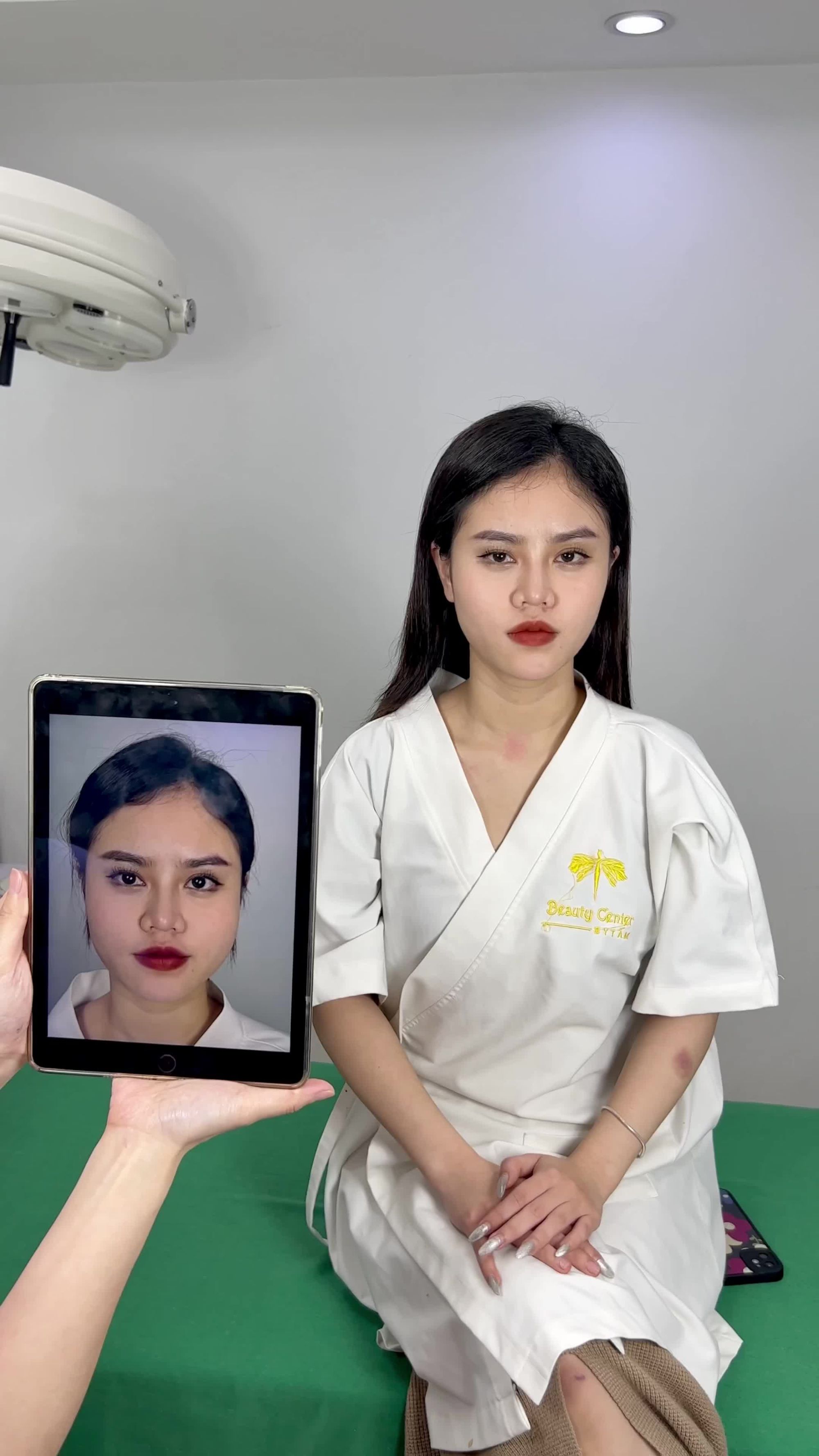 Ca Vline Perfect quay lại tái khám tại TMV Tấm