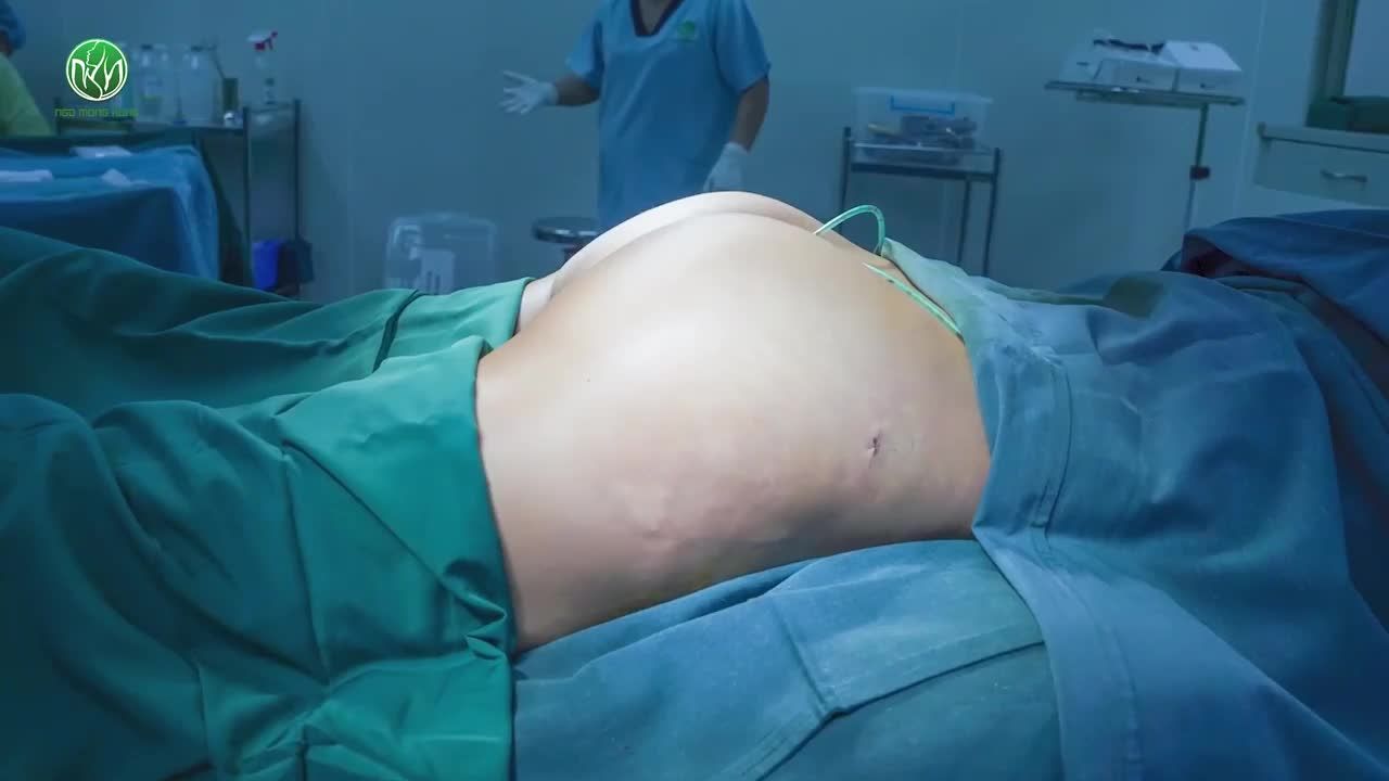 NÂNG MÔNG NỘI SOI CHO CHỊ KHÁCH VIỆT KIỀU