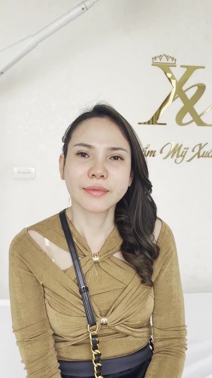 TỪ LÚC CHỊ CẮT MÍ Ở XUÂN HƯƠNG RẤT NHIỀU NGƯỜI HỎI ĐỊA CHỈ VÌ NHÌN MẮT TỰ NHIÊN VÀ LÀNH