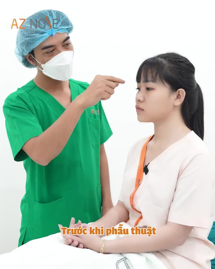Nàng có trán c.ao - môi nh.ọn nên chọn dáng mũi thế nào