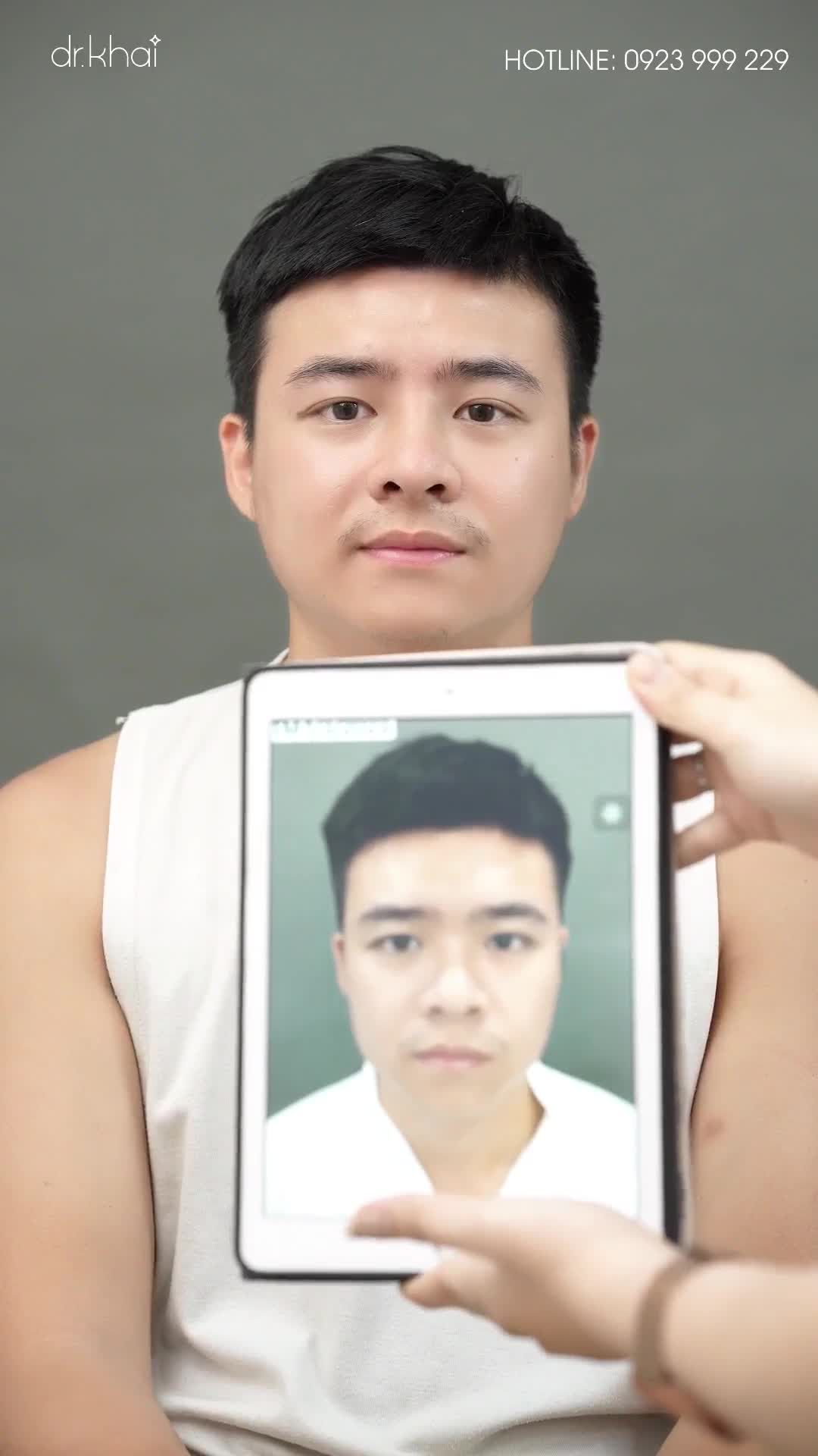 DÁNG MŨI ĐẸP CHO NAM GIỚI