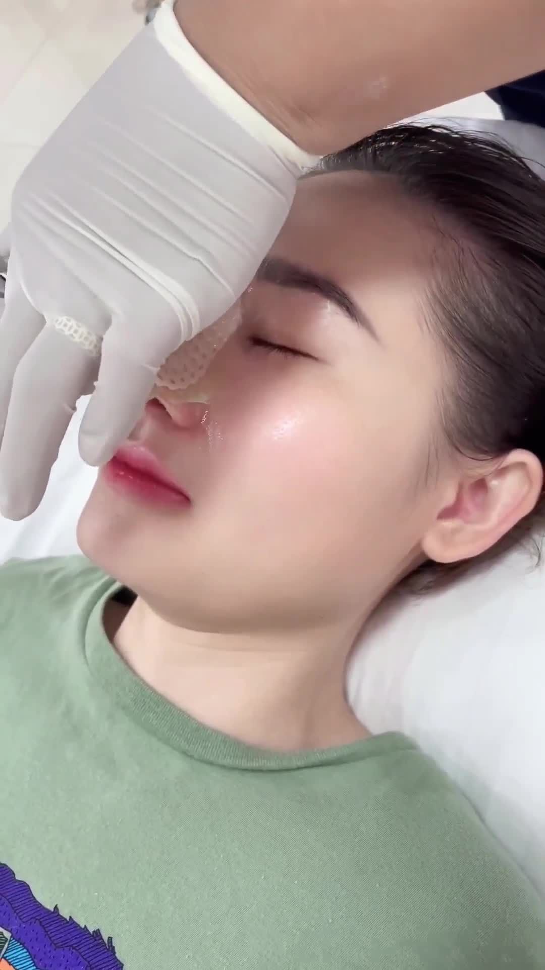 MŨI SỤN SƯỜN ĐẸP QUÁ KHÁCH ƠI