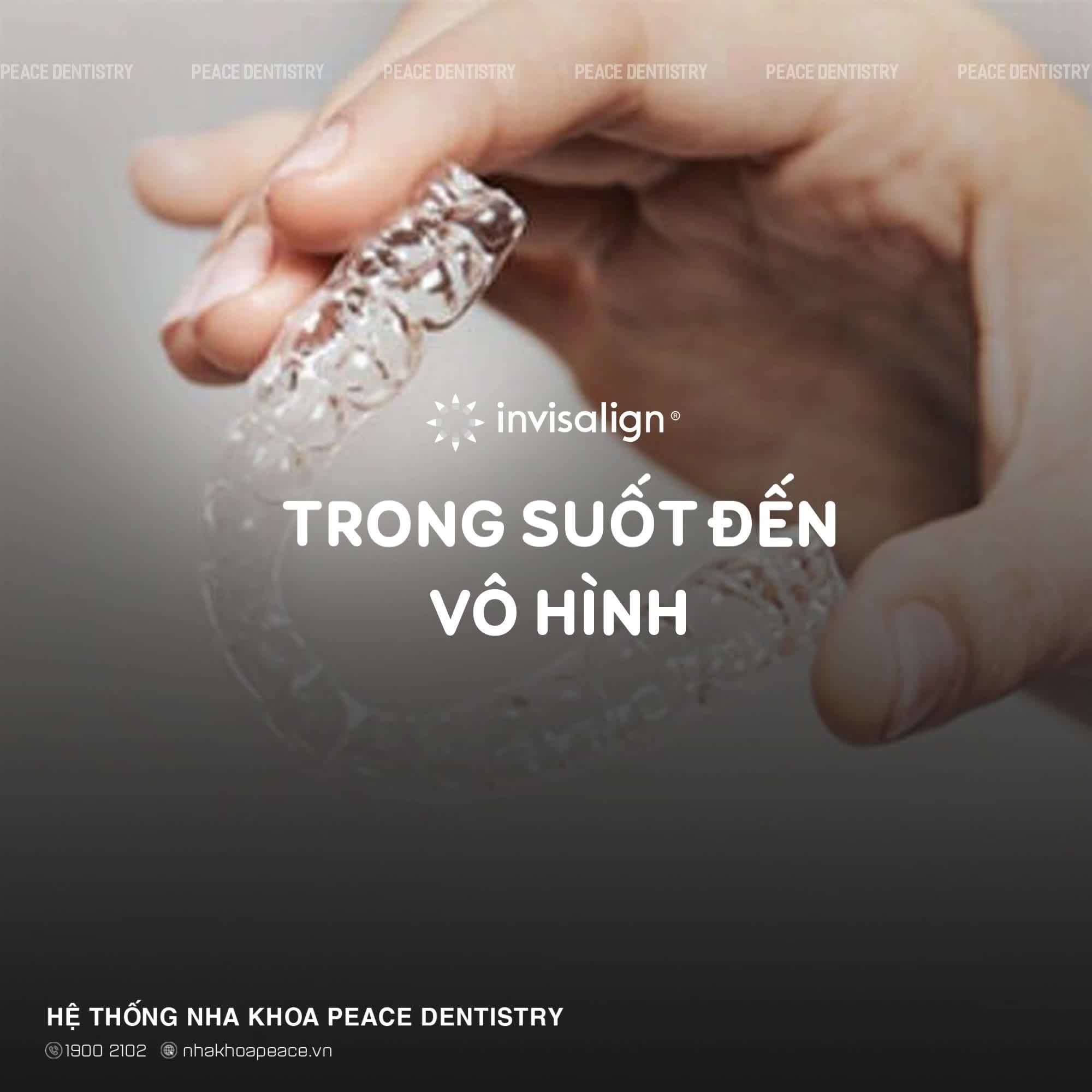 Bạn muốn niềng răng nhưng vẫn còn nhiều lo lắng?