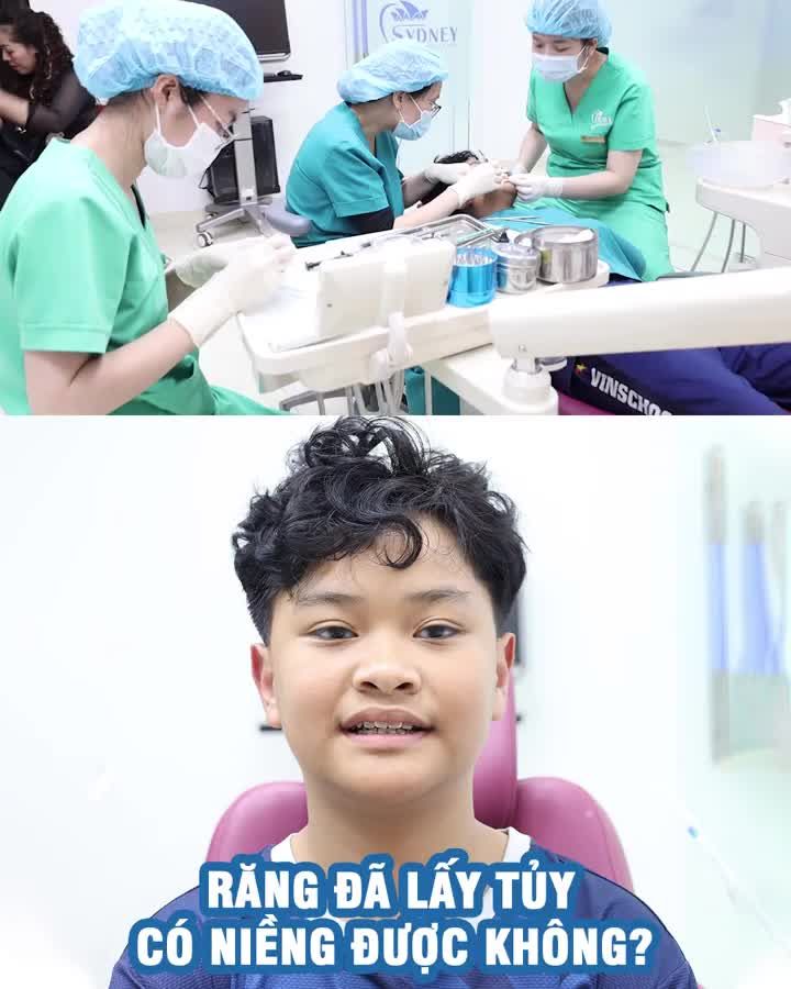Răng đã lấy tủy có niềng được không?
