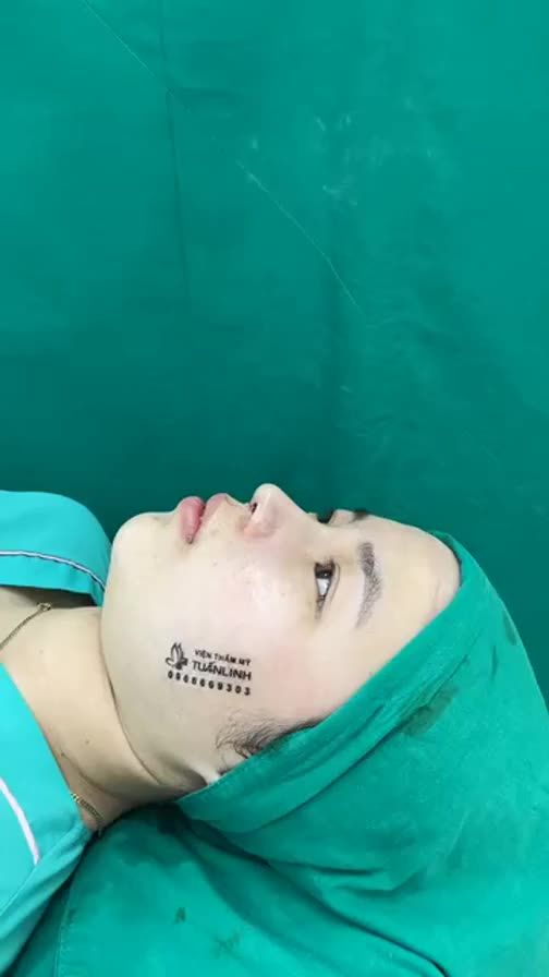 Case mũi cấu trúc cho bạn gái nào thích tự nhiên