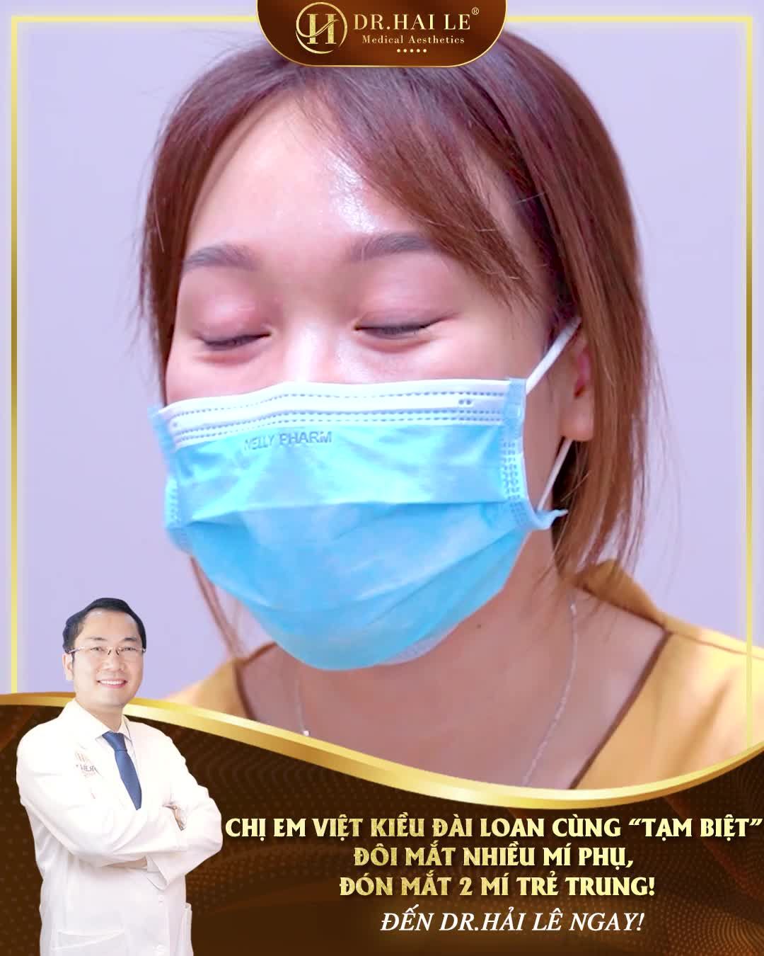 Hai chị em gái Việt Kiều Đài Loan đã thay đổi như thế nào sau khi thực hiện cắt mí tại Dr.Hải Lê?