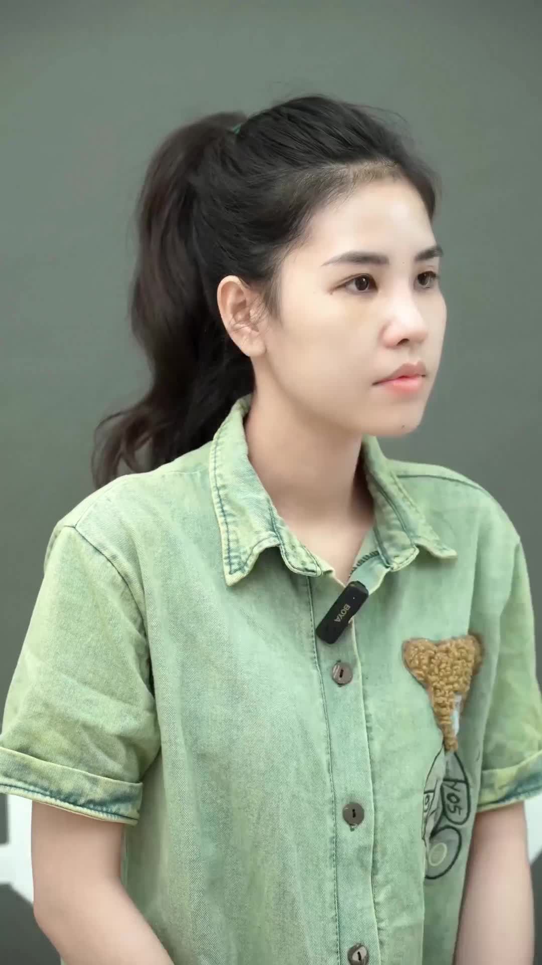 TỰ TIN YÊU ĐỜI HƠN VỚI DÁNG MŨI MỚI