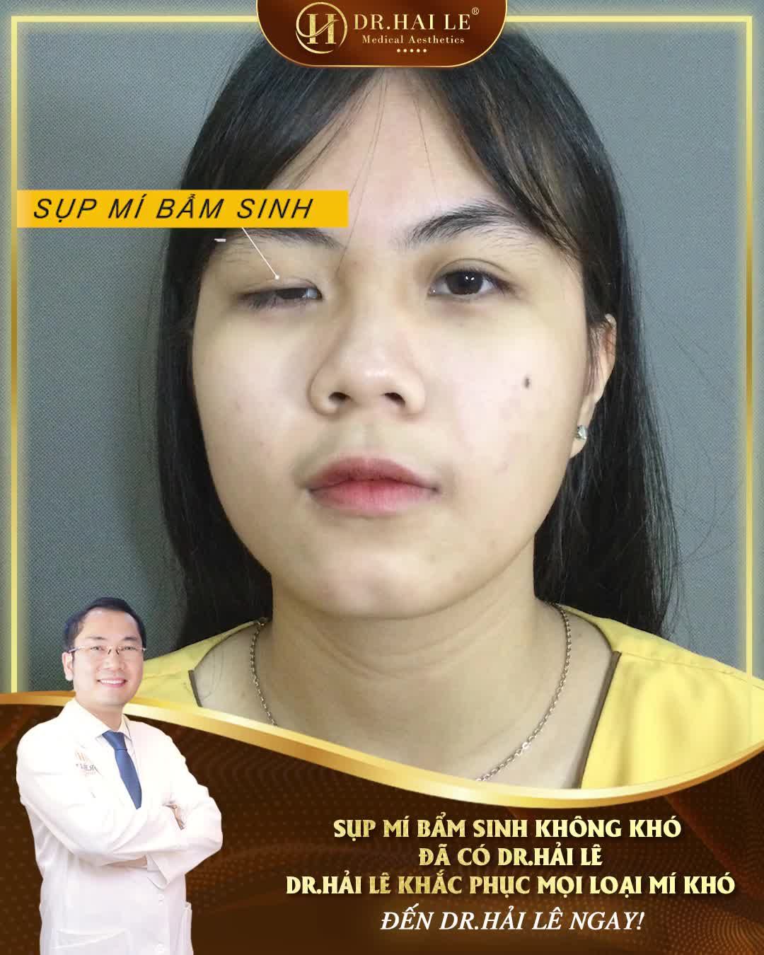 "Bác sĩ đã giúp cho chị có được đôi mắt rất là ưng ý"
