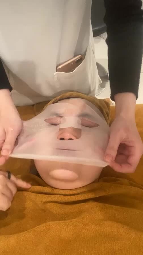 Sau Laser đắp nạ các bạn ạ