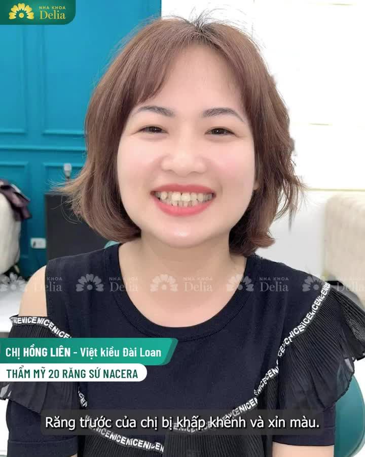 Thẩm mỹ 20 răng sứ cao cấp Nacera tại nha khoa Delia - bí quyết có nụ cười rạng ngời hoàn hảo!