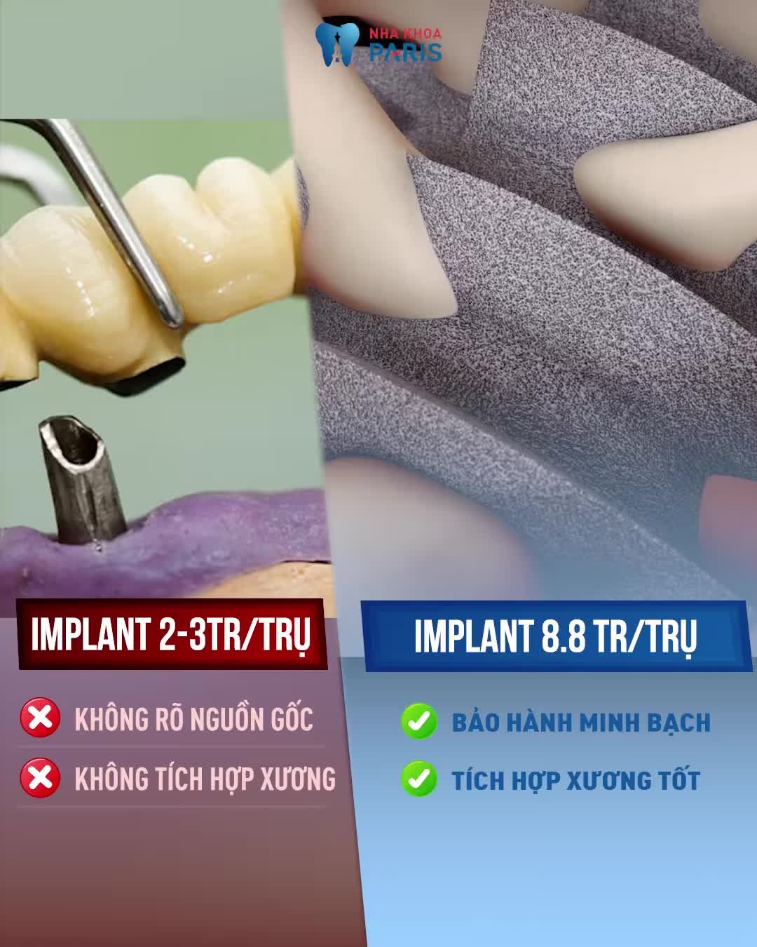 CẤY IMPLANT GIÁ RẺ - TIỀN MẤT TẬT MANG