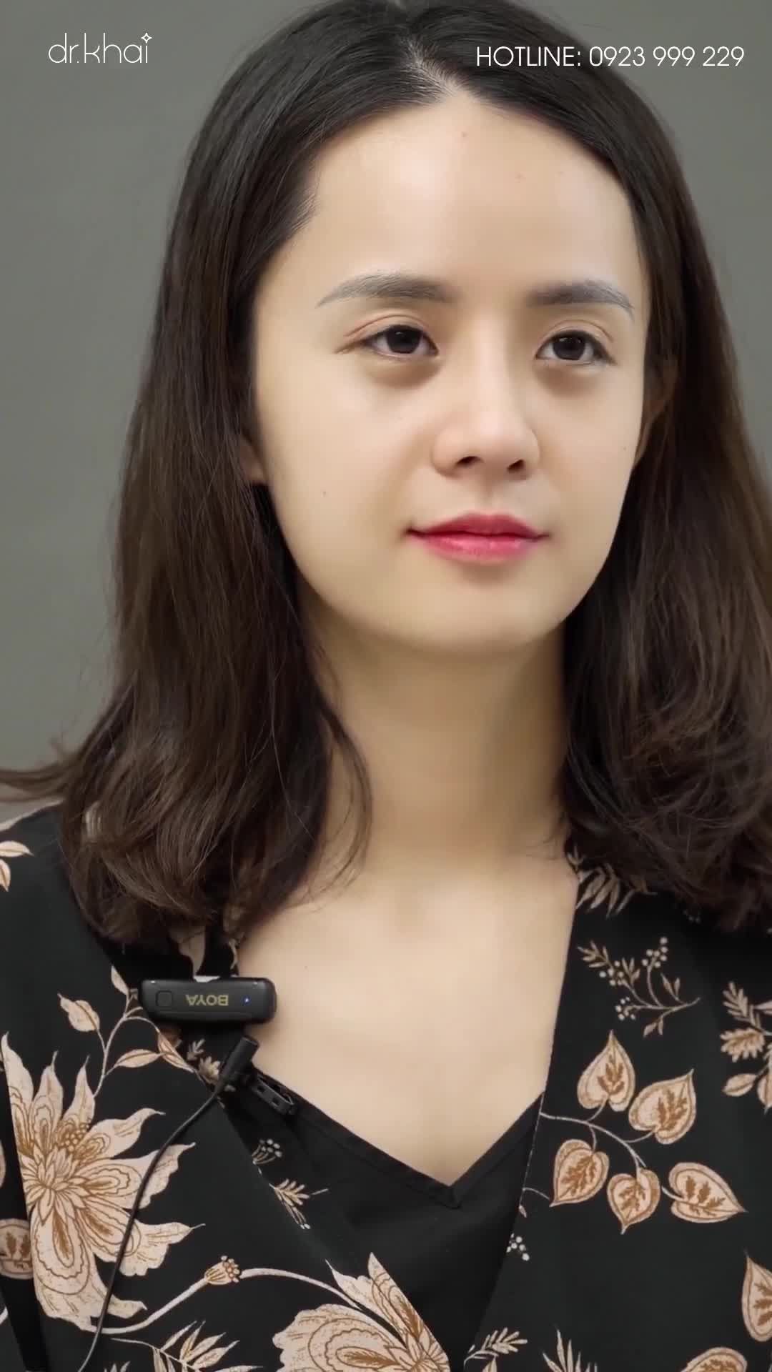 "EM CHỜ 3 NĂM ĐỂ VỀ VIỆT NAM GẶP BÁC SĨ KHẢI NÂNG MŨI"