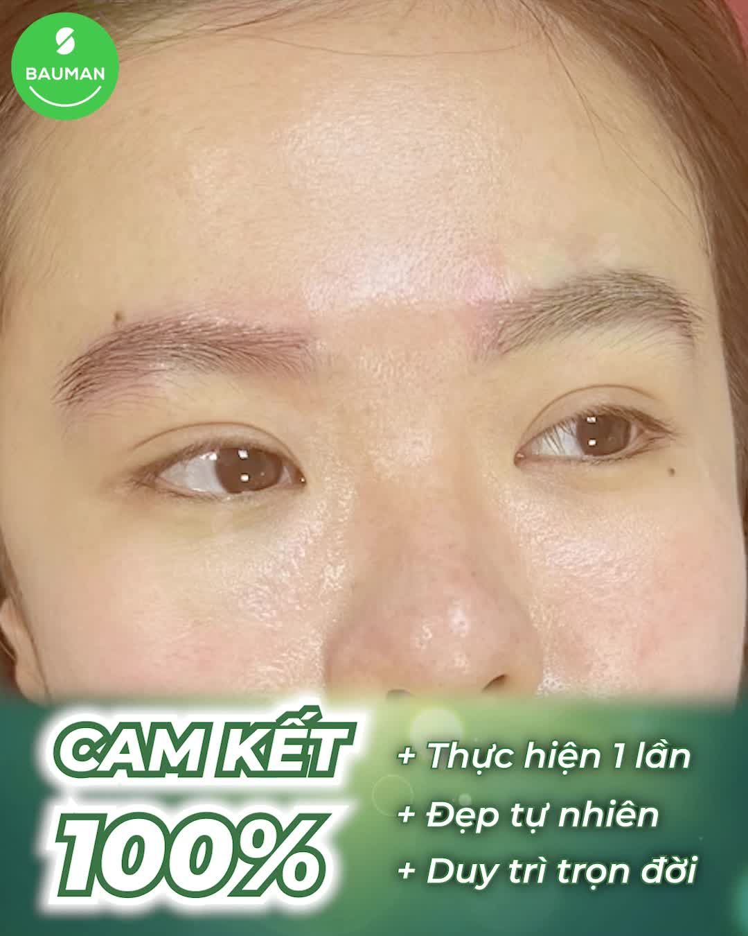 Cấy lông mày tại Bauman Clinic, thực hiện một lần duy trì trọn đời