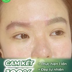 Cấy lông mày tại Bauman Clinic, thực hiện một lần duy trì trọn đời